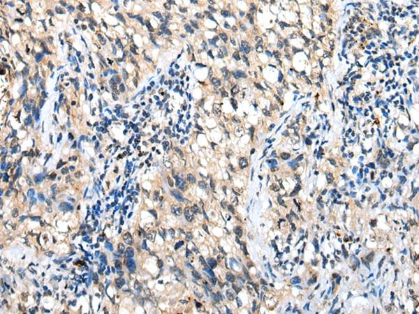 DHRSX Antibody