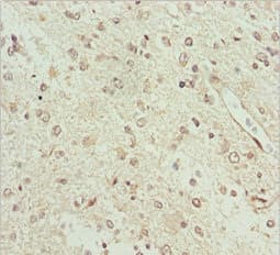 Polyclonal Rabbit anti-Human BCS1L Antibody (IHC, WB)