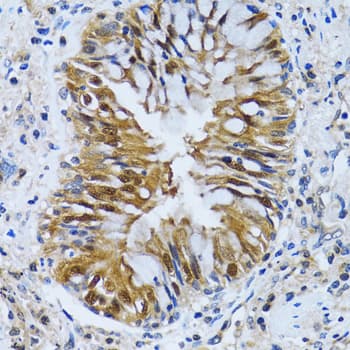 Polyclonal Rabbit anti-Human IMPA1 / IMP Antibody (IHC, IF, WB)
