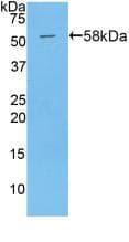 PAPPA / PAPP-A Antibody (aa999-1272, PE)