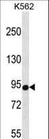CSDE1 Antibody (aa588-615)
