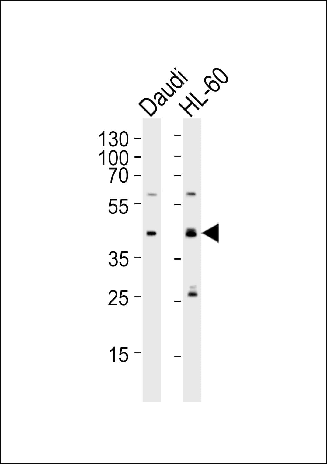CCDC109B Antibody (aa291-320)