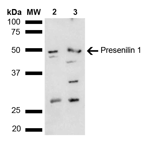 PSEN1 / Presenilin 1 Antibody (RPE)