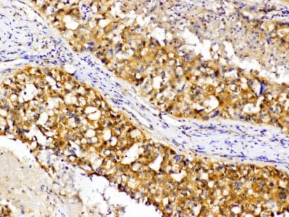 Polyclonal Rabbit anti-Human PRKCA / PKC-Alpha Antibody (phospho-Thr638, IHC, WB)