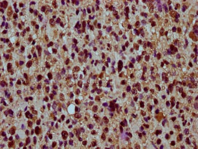 Polyclonal Rabbit anti-Human HIST1H4I Antibody (IHC, IF)