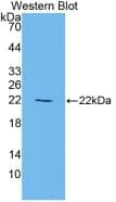 PPARG / PPAR Gamma Antibody (Biotin)