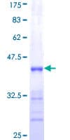 Human SHOX2 Protein (Recombinant GST, N-terminus)