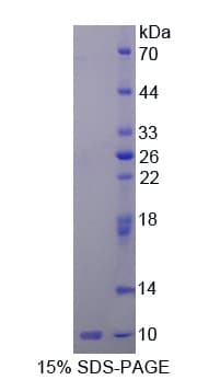 Rat IGF2 Protein (Recombinant His)