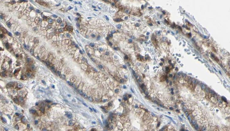 TNFRSF10B / Killer / DR5 Antibody