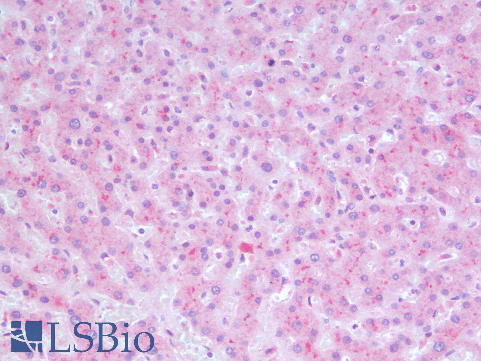 PathPlus™ Polyclonal Rabbit anti-Human PIK3CA / PI3K Alpha Antibody (IHC)