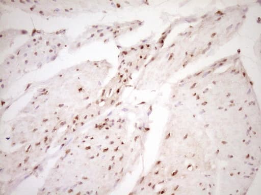 LPIN1 / Lipin 1 Antibody (clone OTI8F10)