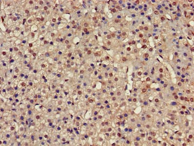 PSMC4 Antibody