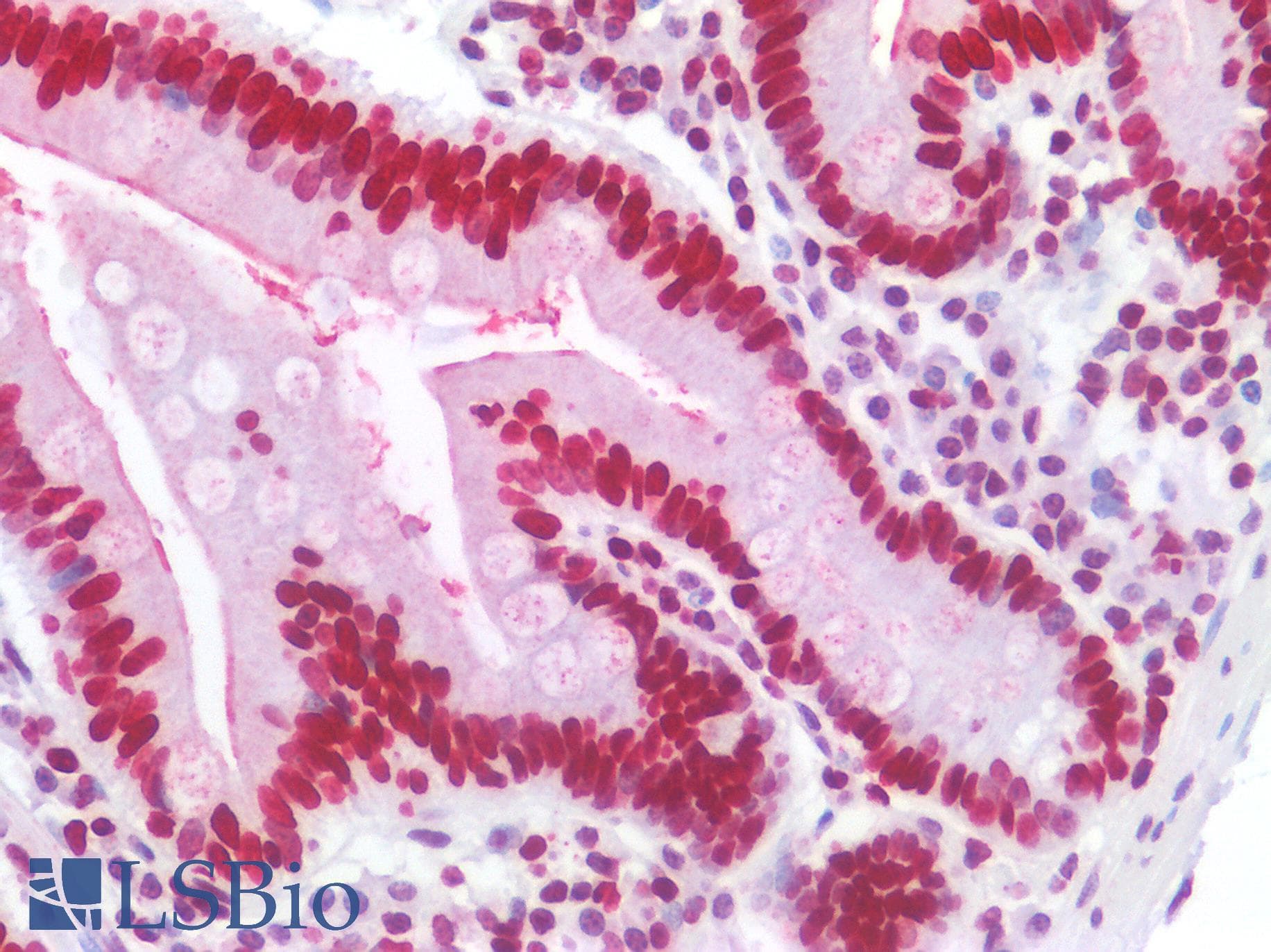 IHC-plus™ Polyclonal Rabbit anti-Human HIST1H1B Antibody (IHC, IF, WB)