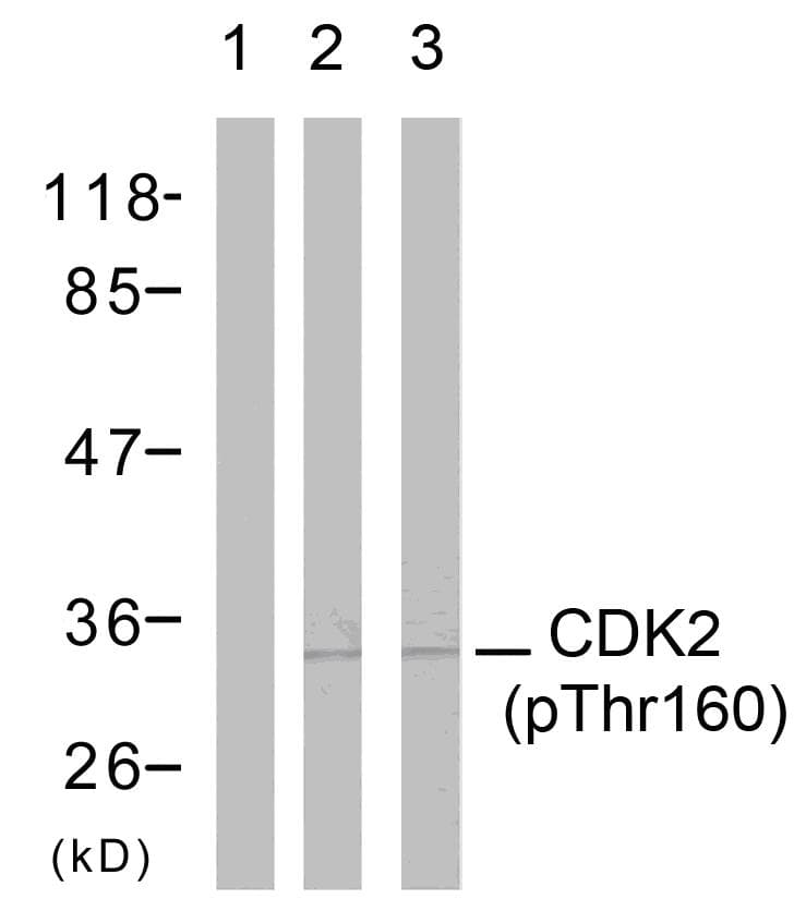 CDK2 Antibody (phospho-Thr160)