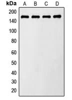 Polyclonal Rabbit anti-Human TBC1D4 / AS160 Antibody (phospho-Thr642, IHC, IF, WB)