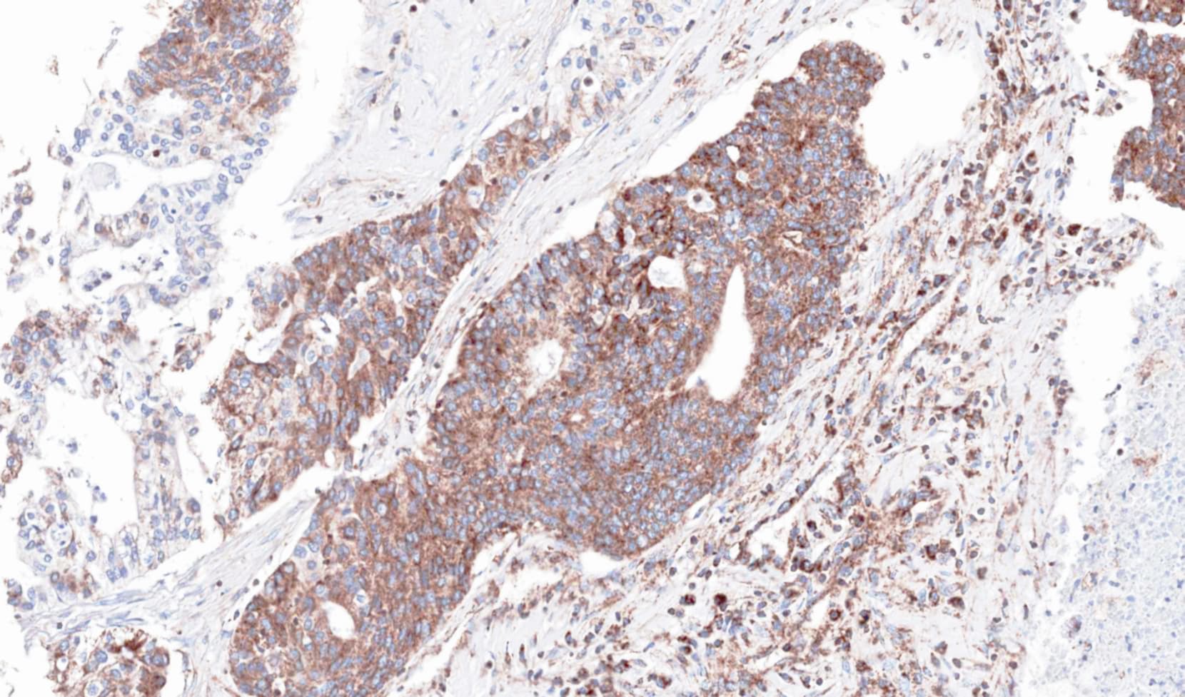 NDUFS4 Antibody (aa1-175)