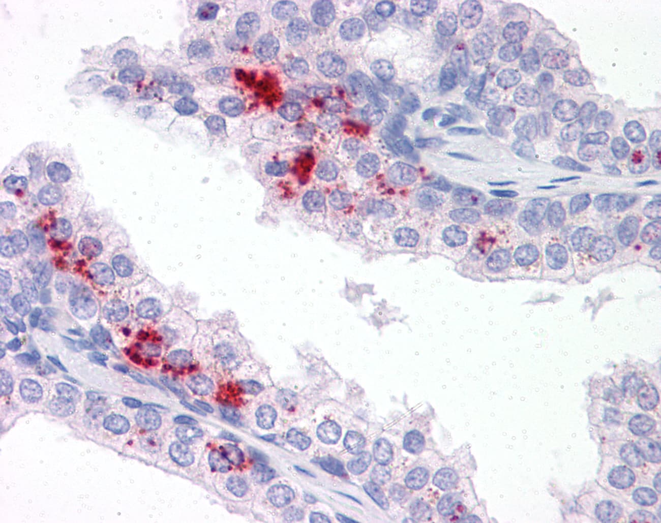IHC-plus™ Polyclonal Rabbit anti-Human TM9SF1 Antibody (N-Terminus, IHC)