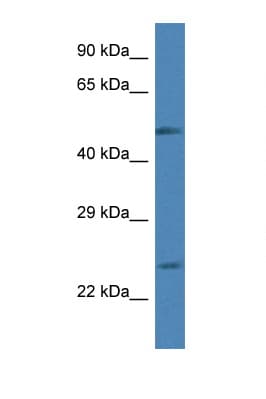 Polyclonal Rabbit anti-Human RAB2A / RAB2 Antibody (C-Terminus, WB)