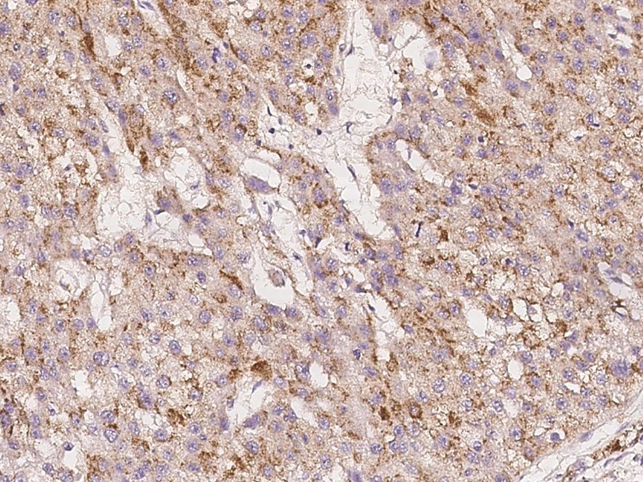 IGHMBP2 Antibody