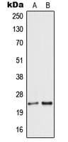 Polyclonal Rabbit anti-Human SCG5 / 7B2 Antibody (Internal, WB)