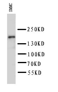 KDR / VEGFR2 / FLK1 Antibody (aa454-469)