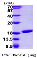 Human UBE2N / UBC13 Protein (Recombinant 6His, N-terminus)