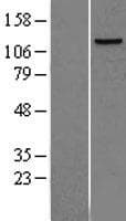 POLD1 Protein (Over-Expression Lysate Myc-DDK (Flag))