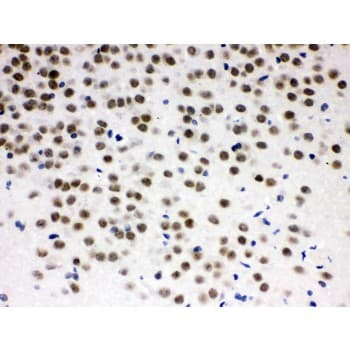 ZBTB7A / Pokemon Antibody (aa125-163)
