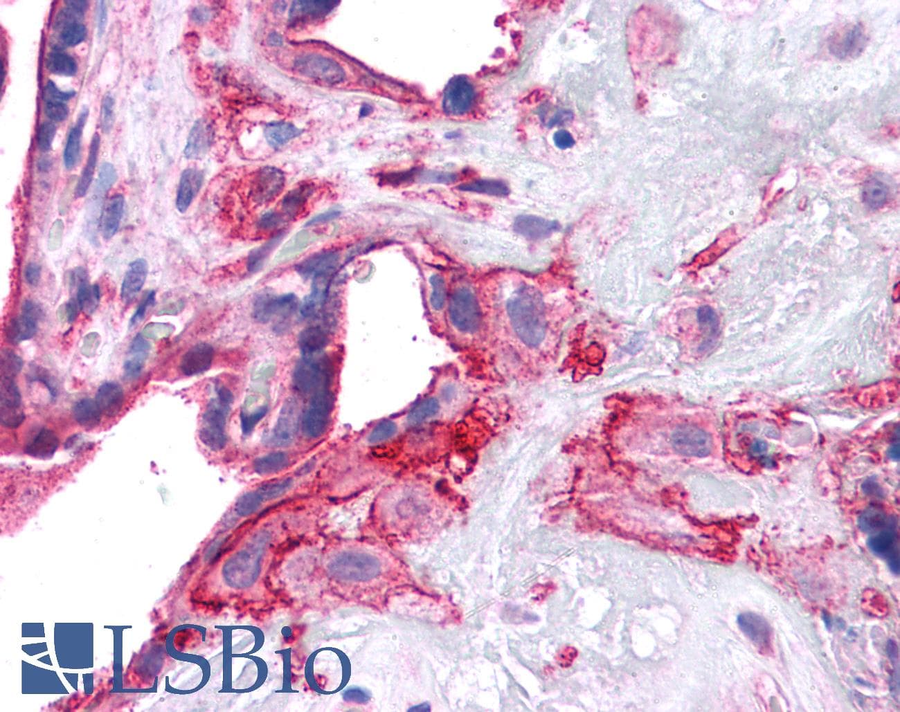 IHC-plus™ Polyclonal Rabbit anti-Human SNAP23 / SNAP-23 Antibody (IHC, WB)