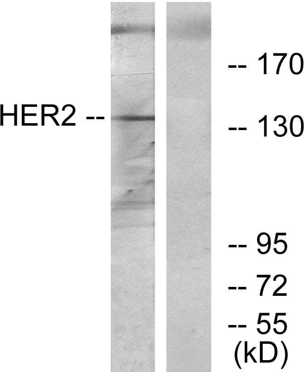 ERBB2 / HER2 Antibody