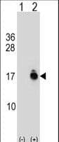 ACYP1 Antibody (aa52-80)