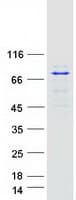 Human BTK Protein (Recombinant Myc-DDK (Flag))