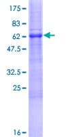 Human ACBD4 Protein (Recombinant GST)