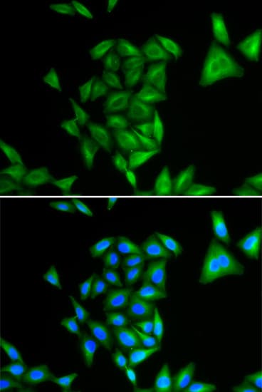 RD / PHYH Antibody