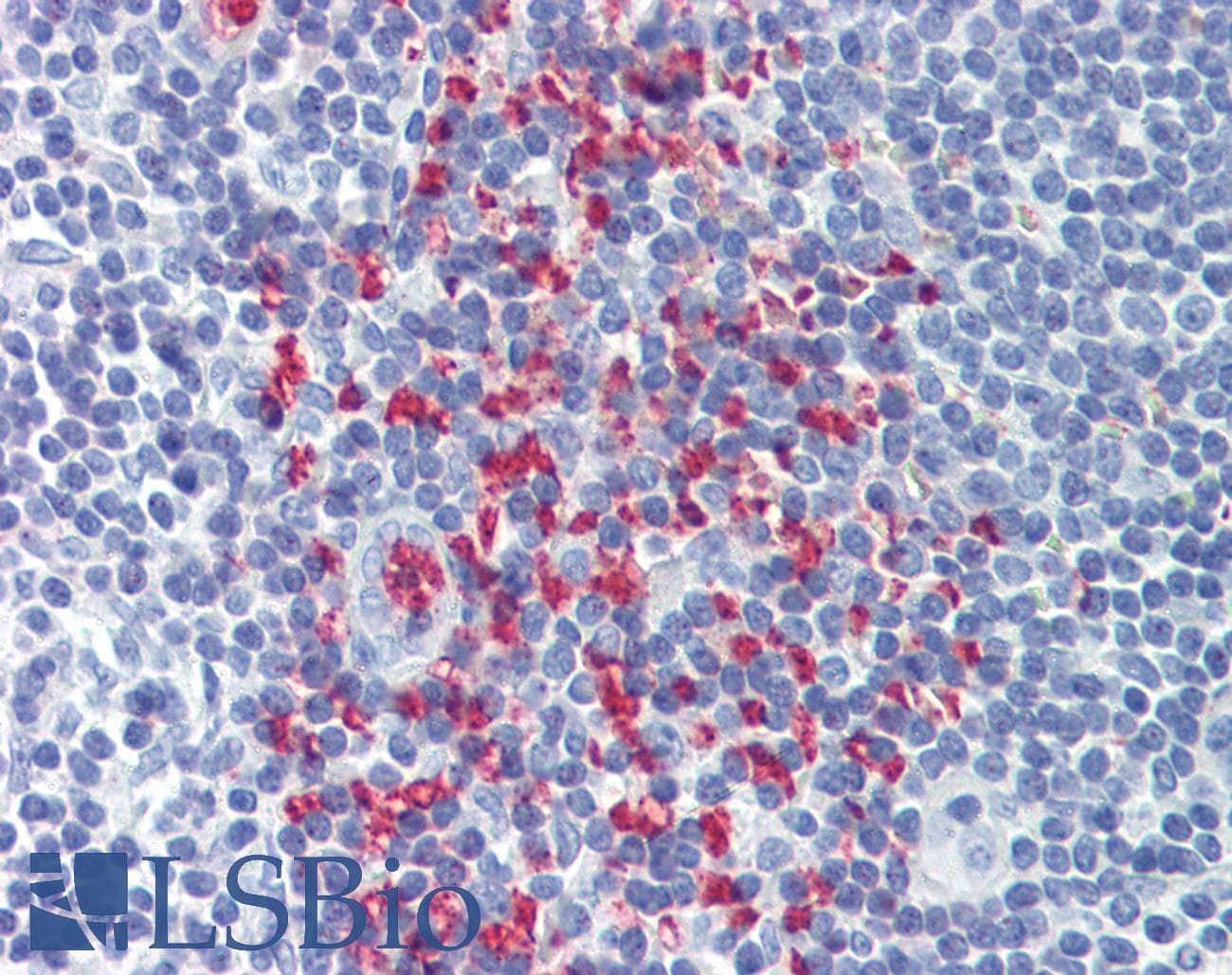 IHC-plus™ Polyclonal Goat anti-Human CLEC2D / OCIL / LLT1 Antibody (aa122-131, IHC, IF, WB)