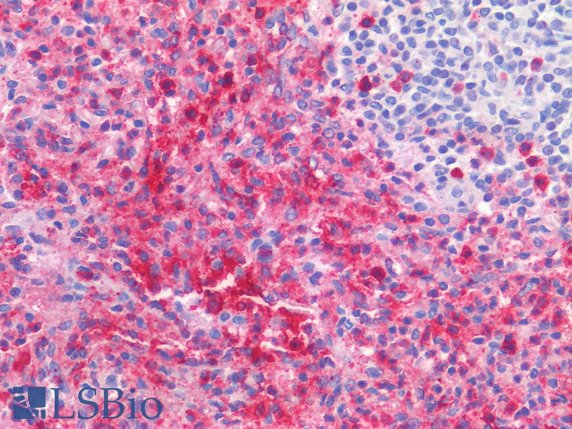 IHC-plus™ Monoclonal Mouse anti-Human FCGR3B / CD16B Antibody (clone 21, Preservative Free, IHC)