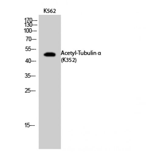 Polyclonal Rabbit anti-Human Alpha Tubulin Antibody (acetylation site of K352., WB)