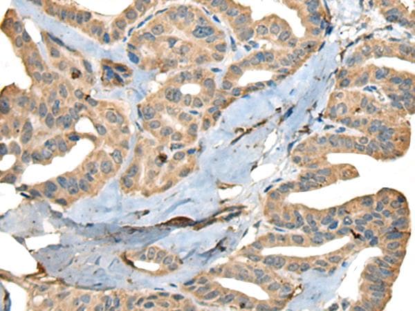 Polyclonal Rabbit anti-Human CDADC1 Antibody (IHC)