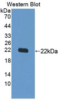 SVIL / Supervillin Antibody (aa1617-1788, Biotin)