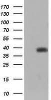 Monoclonal Mouse anti-Human TRIM44 Antibody (clone OTI1E10, IHC, IF, WB)