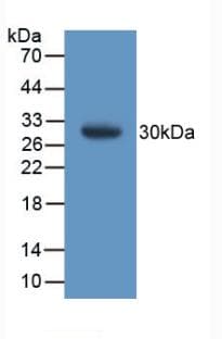 GSTT1 Antibody (aa7-240)