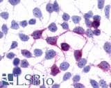 PathPlus™ Polyclonal Rabbit anti-Human GPR45 Antibody (Cytoplasmic Domain, IHC)