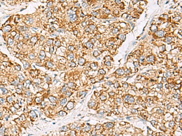 ZPBP2 Antibody
