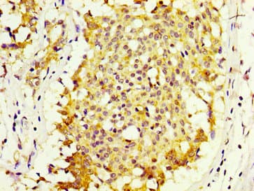 MKRN1 Antibody