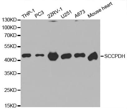 Polyclonal Rabbit anti-Human SCCPDH Antibody (IHC, WB)