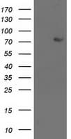 LIMK1 / LIMK Antibody (clone OTI6A7)