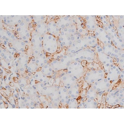 Polyclonal Rabbit anti-Human MAPT / Tau Antibody (phospho-Thr181, IHC, WB)