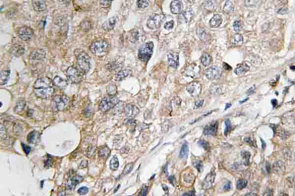 Polyclonal Rabbit anti-Human DUSP1 / MKP1 Antibody (Gln290, IHC, WB)