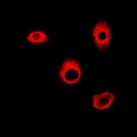 Polyclonal Rabbit anti-Human HAGH Antibody (IHC, IF, WB)
