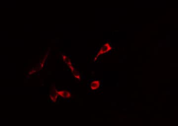 Polyclonal Rabbit anti-Human KRT20 / CK20 / Cytokeratin 20 Antibody (IHC, IF, WB)